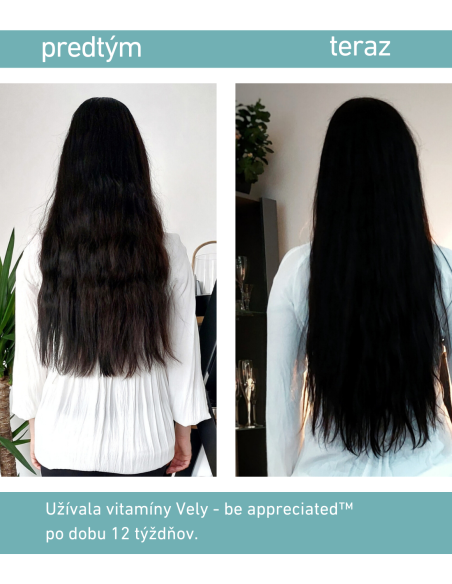 Gumené vitamíny pre silné vlasy