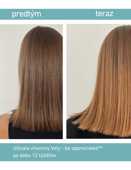 Gumené vitamíny pre silné vlasy